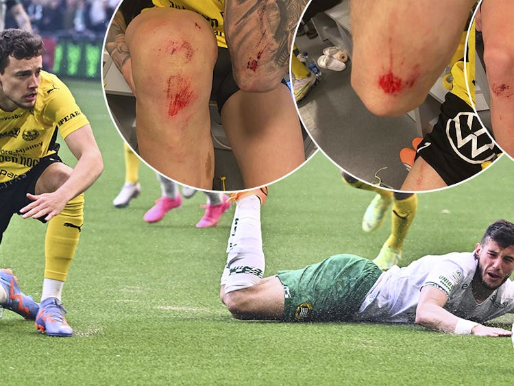 Mjällbys Colin Rösler och Hammarbys Viktor Dukanovic i en match där spelarnas skador dokumenterades av Mjällbys sportchef Jacob Lennartsson.