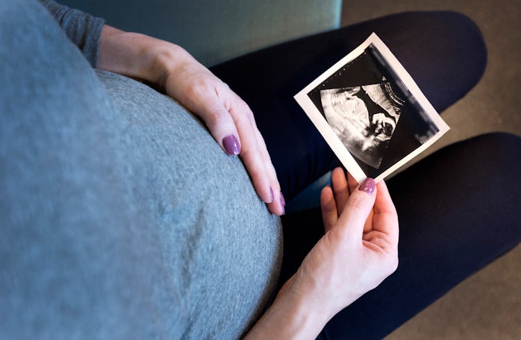 En gravid kvinna håller ett ultraljudfoto av sitt barn.