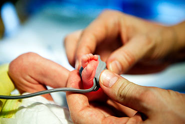 Fingrarna är för små och i stället mäts syrehalten i blodet på bebisens fot.