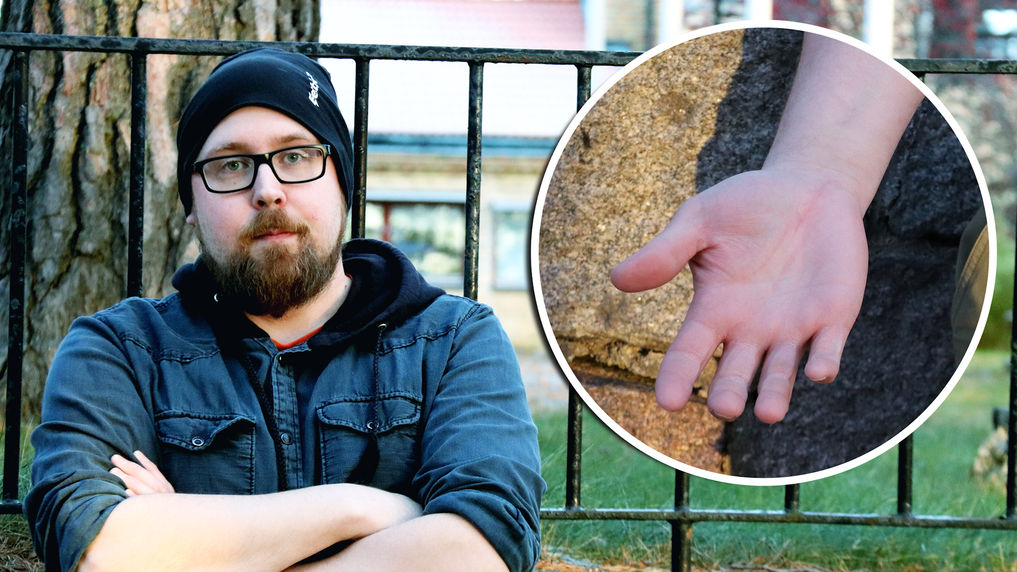 Niklas Katajamäki invid en bild på hans skadade hand.
