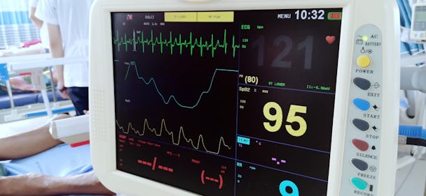 Skärmen på en EKG-maskin